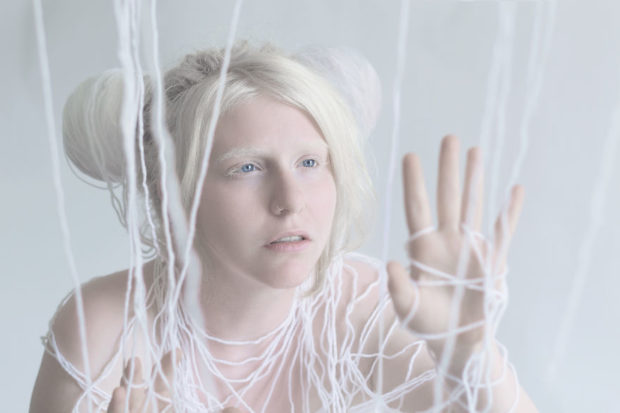 albinos_6